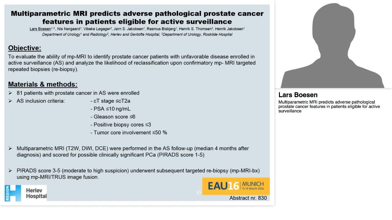 Multiparametric MRI predicts adverse pathological prostat-