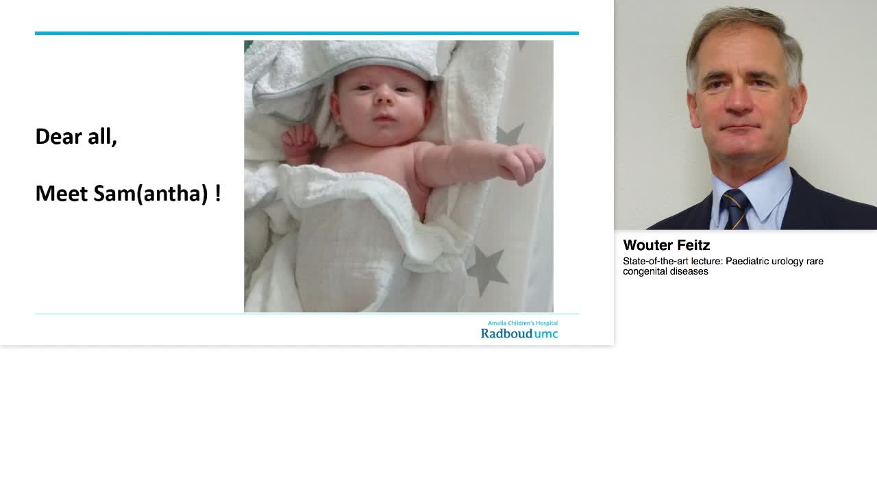 Paediatric urology rare congenital diseases