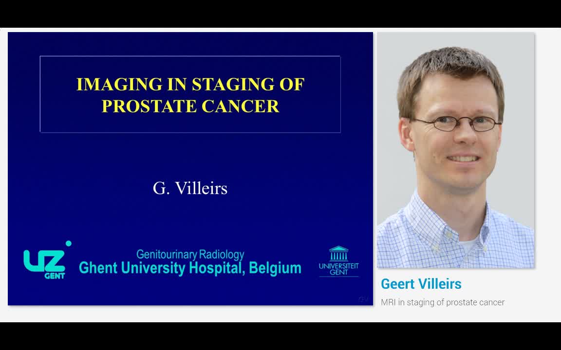 MRI in staging of prostate cancer
