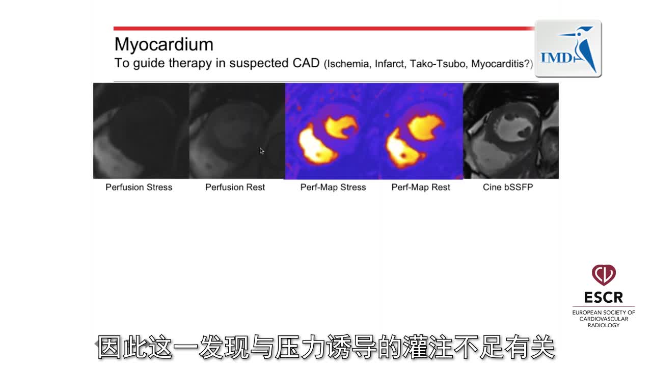 成像在器质性心脏病现代治疗中的作用 2