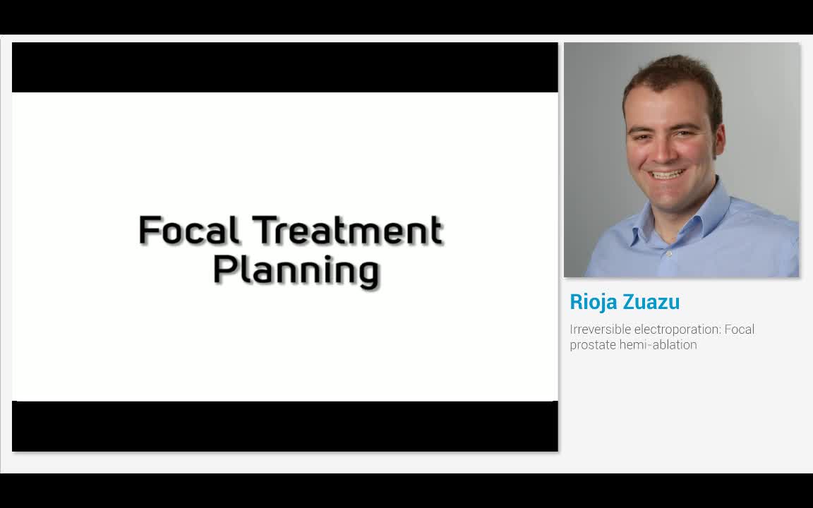 Irreversible electroporation, Focal prostate hemi-ablation