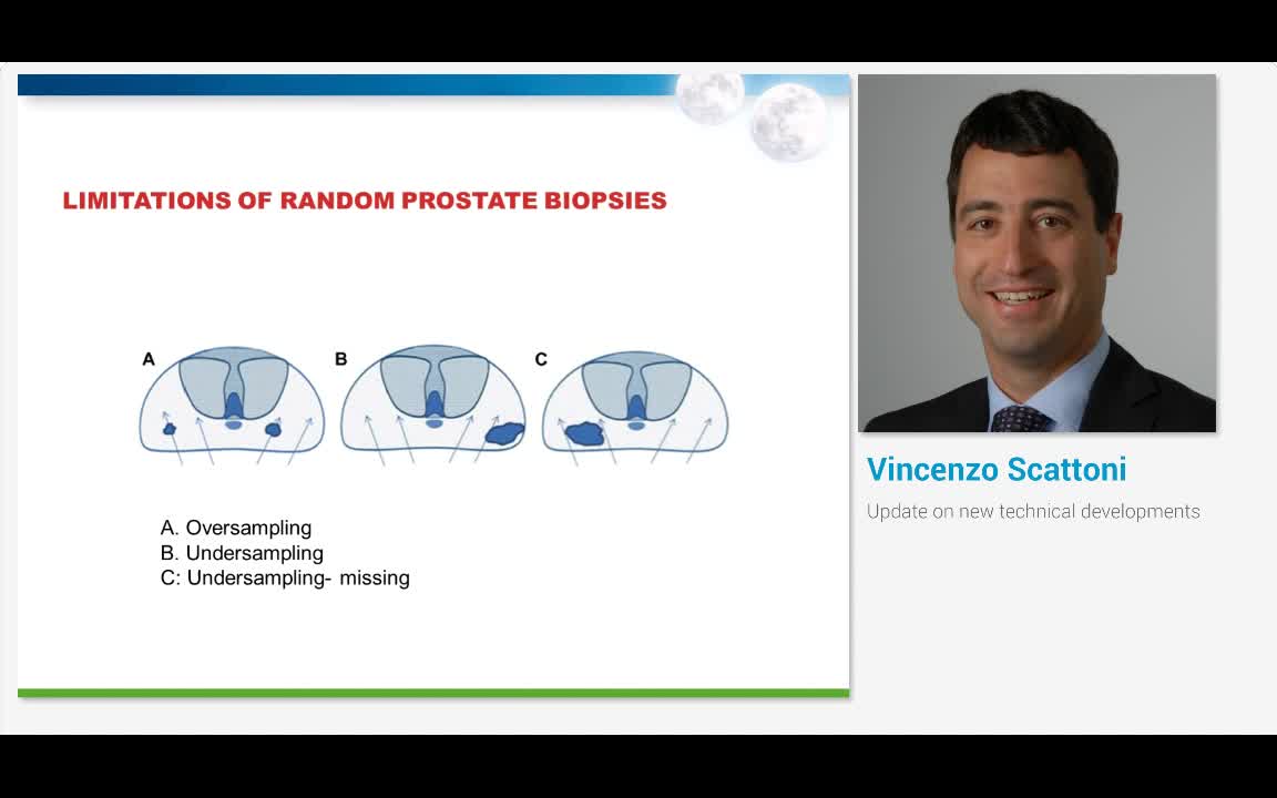 Update on new technical developments