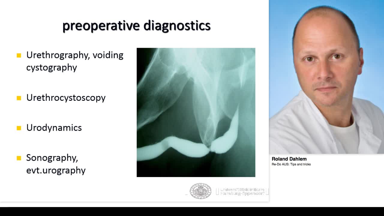 Re-Do AUS, Tips and tricks