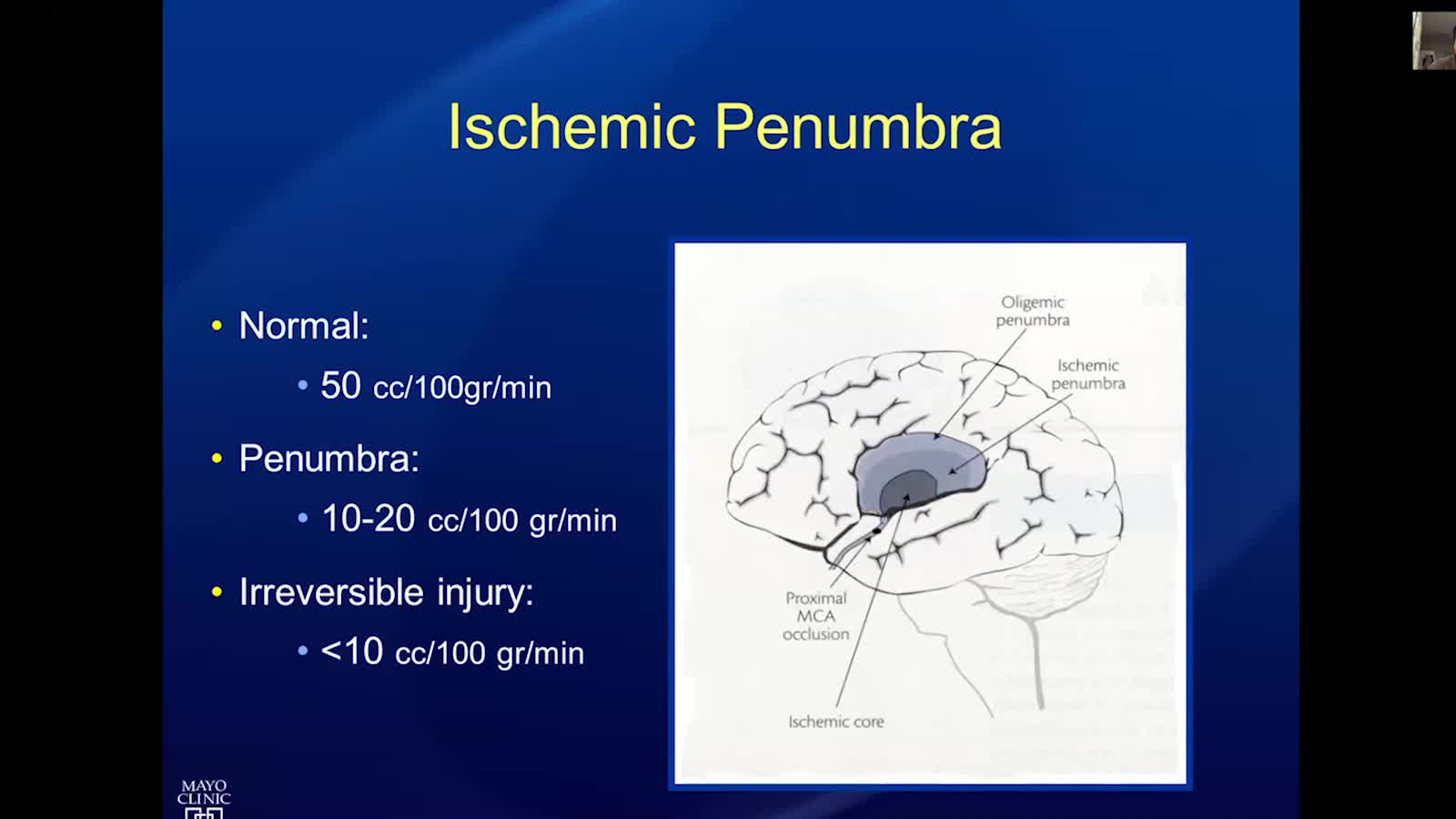 1-2 缺血和出血性卒中的血管内治疗管理-Rabinstein_（新增问答）