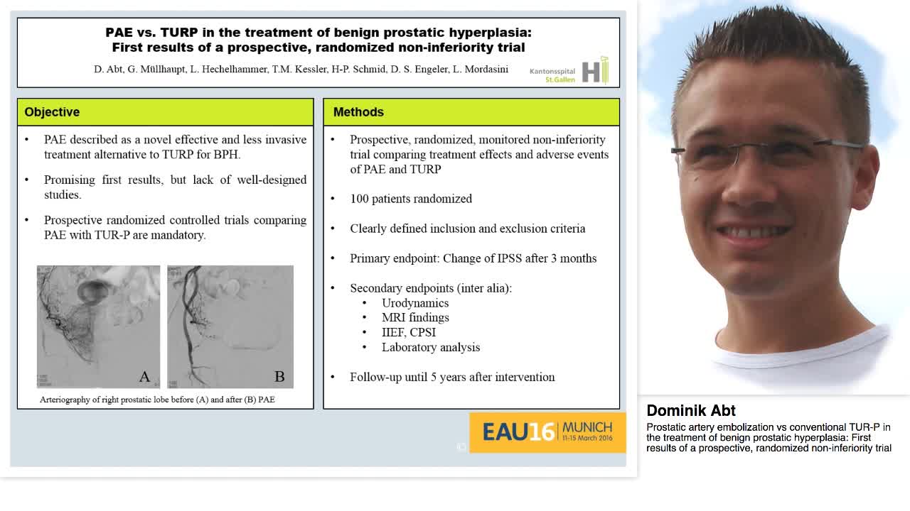 Prostatic artery embolization vs conventional TUR-P in th-