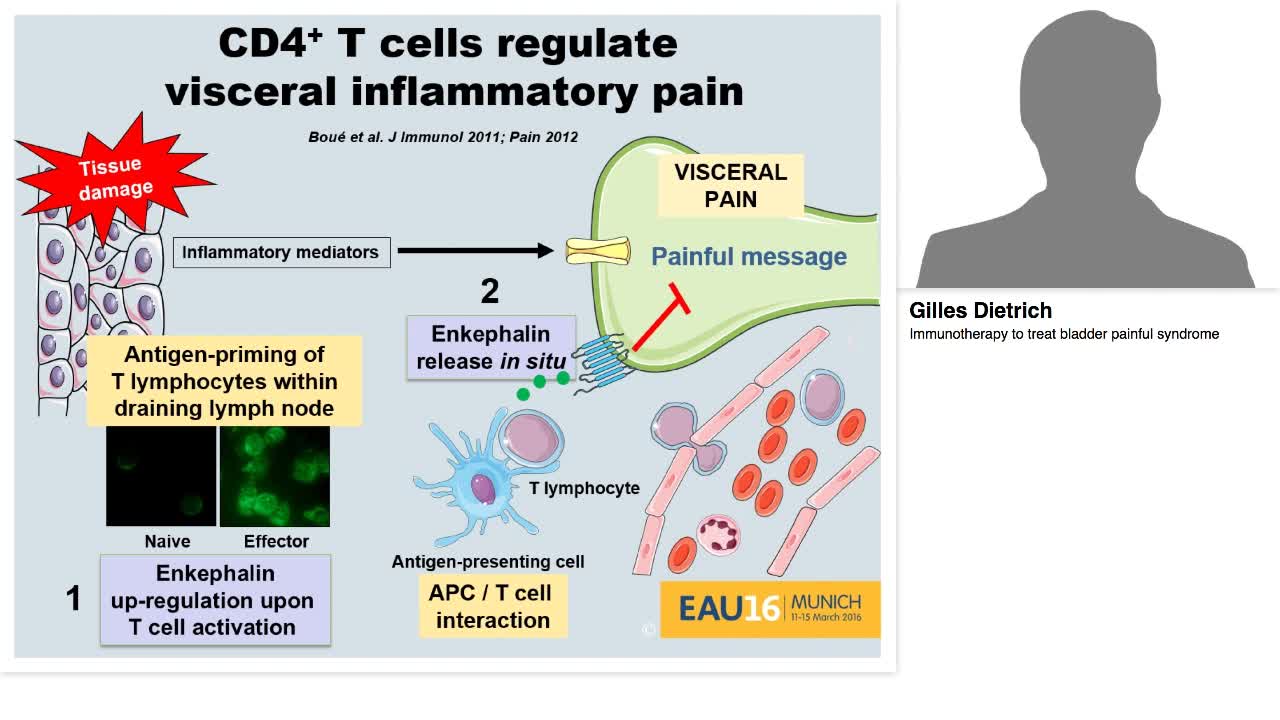 Immunotherapy to treat bladder painful syndrome