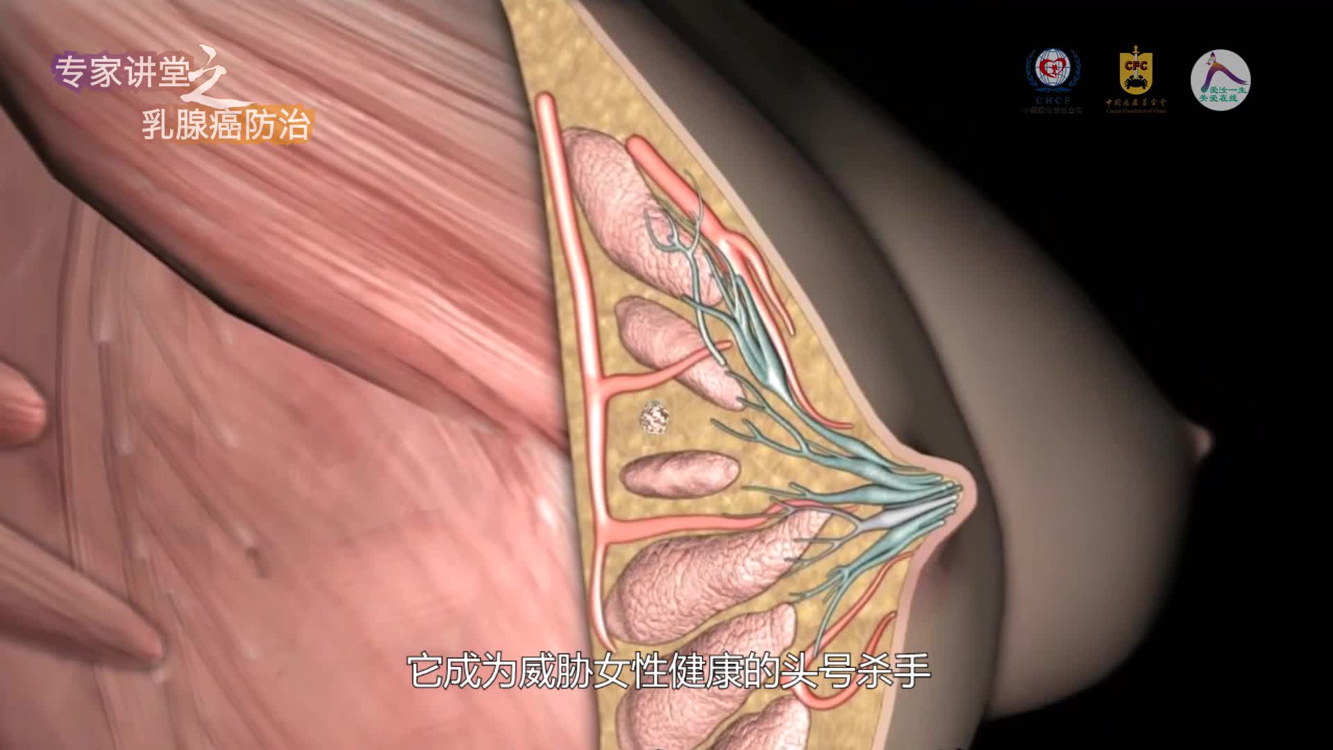 爱汝一生乳腺癌患者关爱科普平台--南京 赵平
