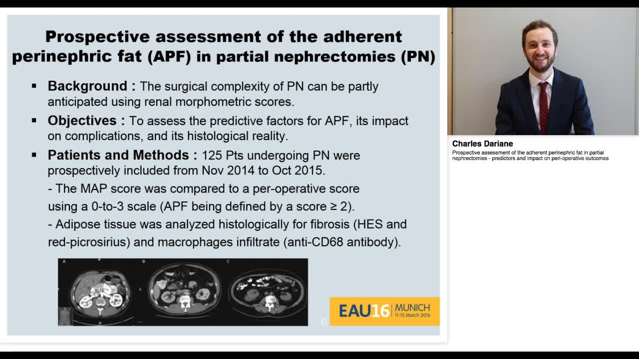 Prospective assessment of the adherent perinephric fat in-