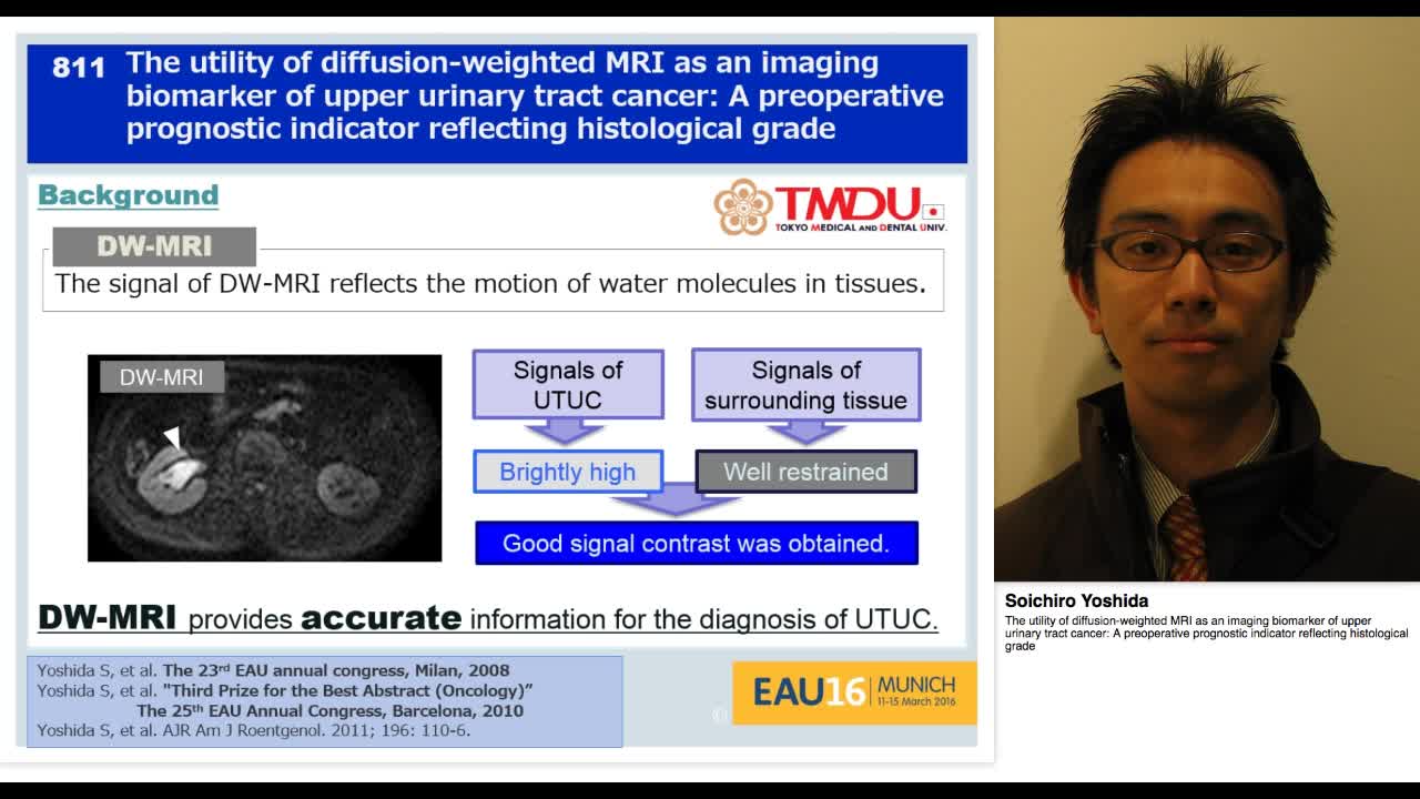 The utility of diffusion-weighted MRI as an imaging bioma-