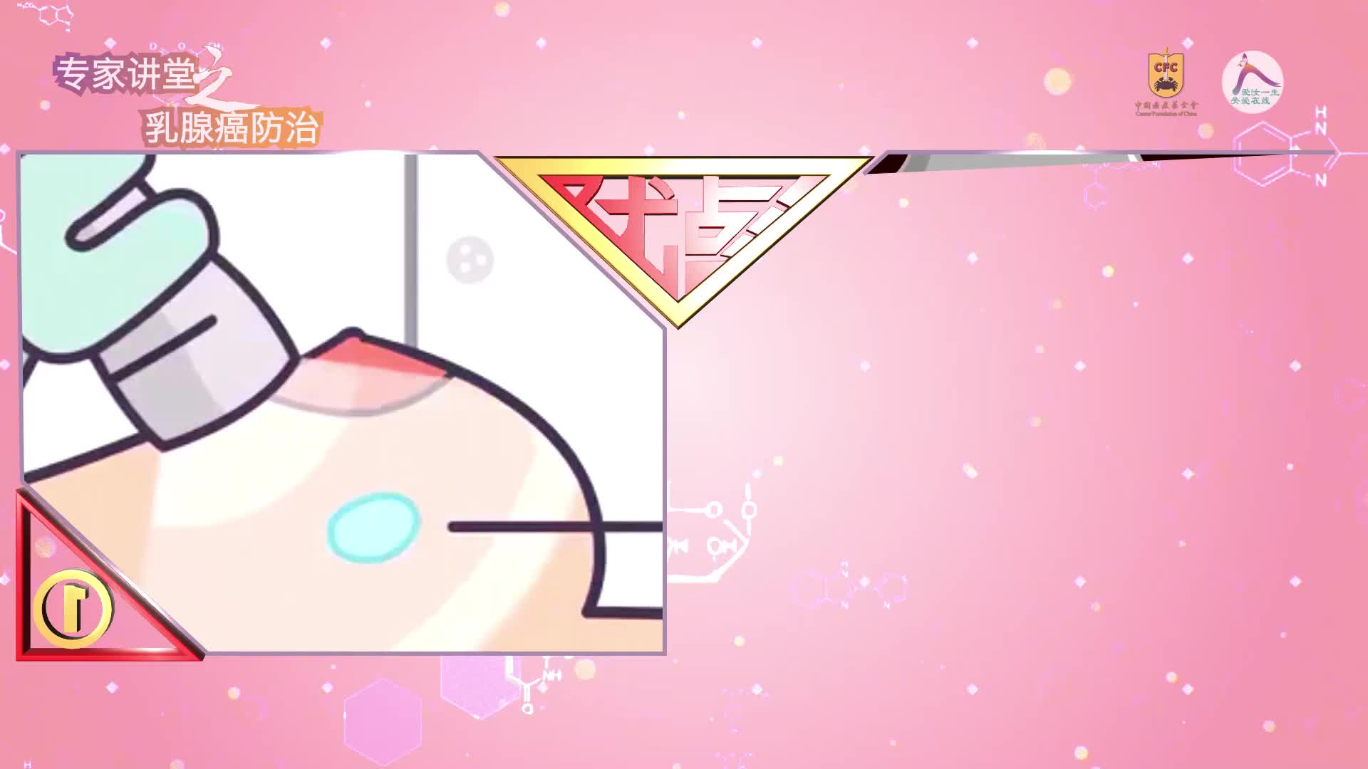 34 冉浩男：浅谈乳腺癌的术中放射治疗