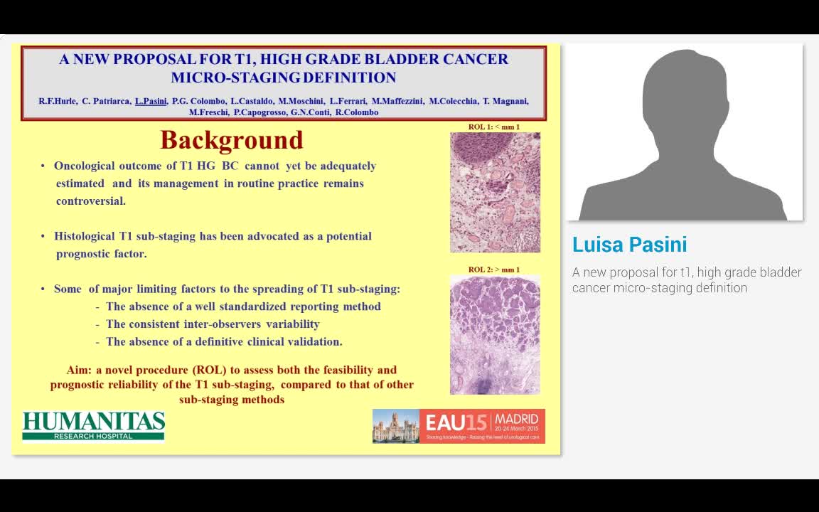 A new proposal for t1, high grade bladder cancer micro-st..-