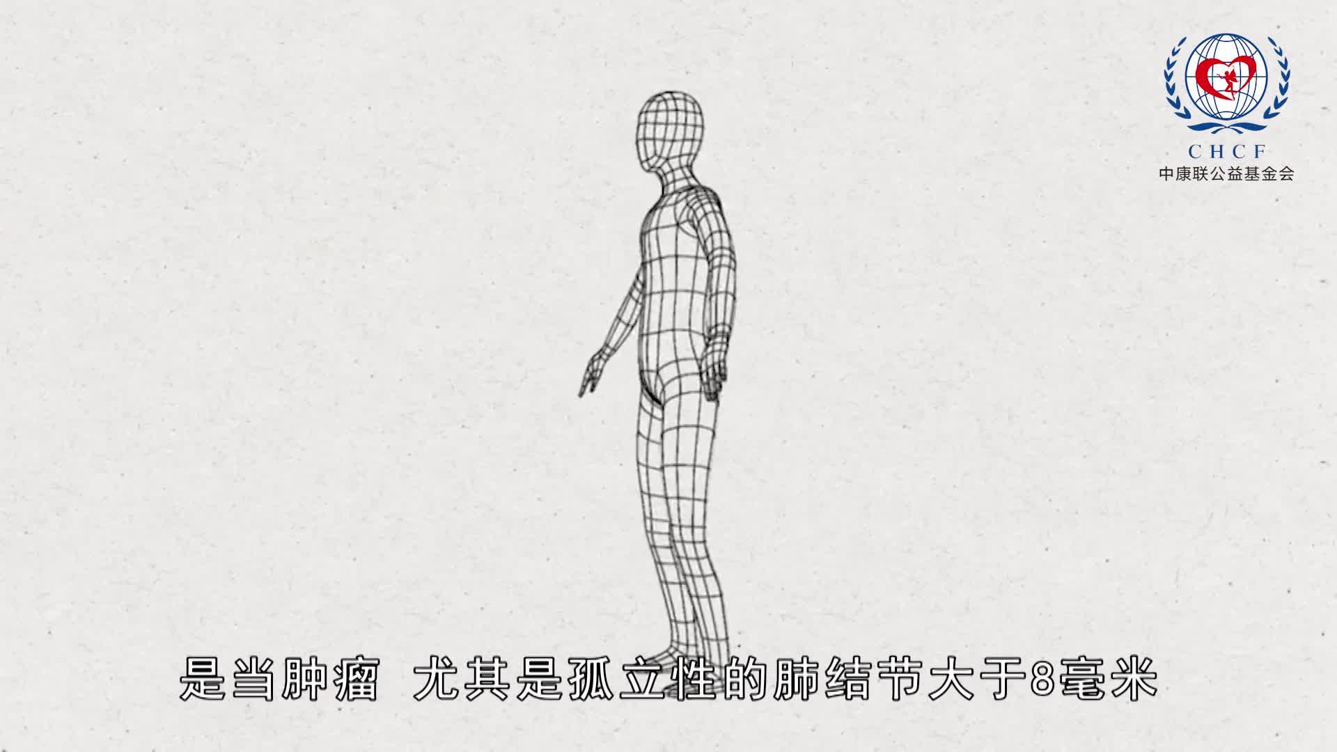 宋少丽：PET-CT在肺癌诊疗中的应用