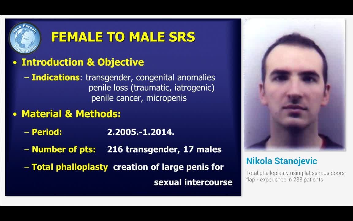 Total phalloplasty using latissimus doors flap - experien..-