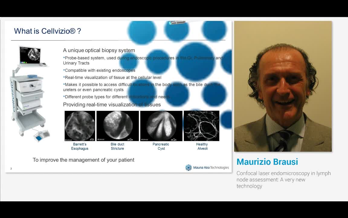 Confocal laser endomicroscopy in lymph node assessment, A..-