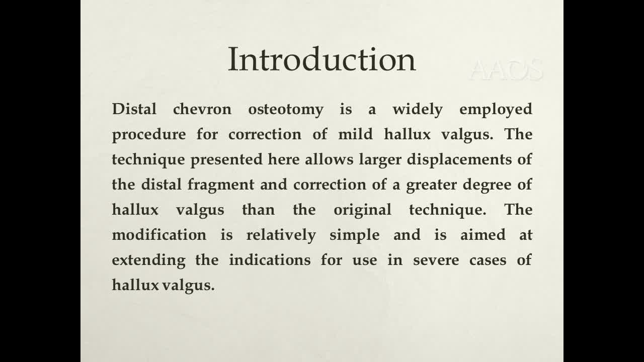 Chevron Shaft Osteotomyfor Moderate and Severe Hallux Valgus