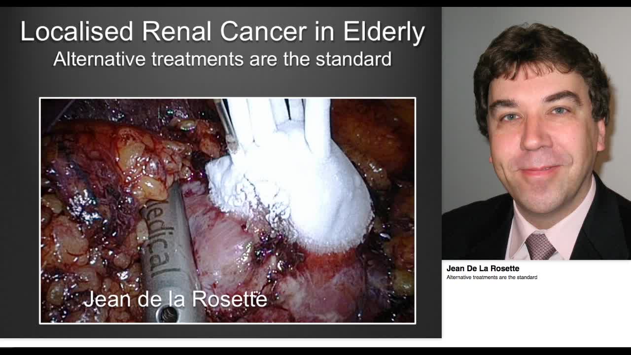 Alternative treatments are the standard