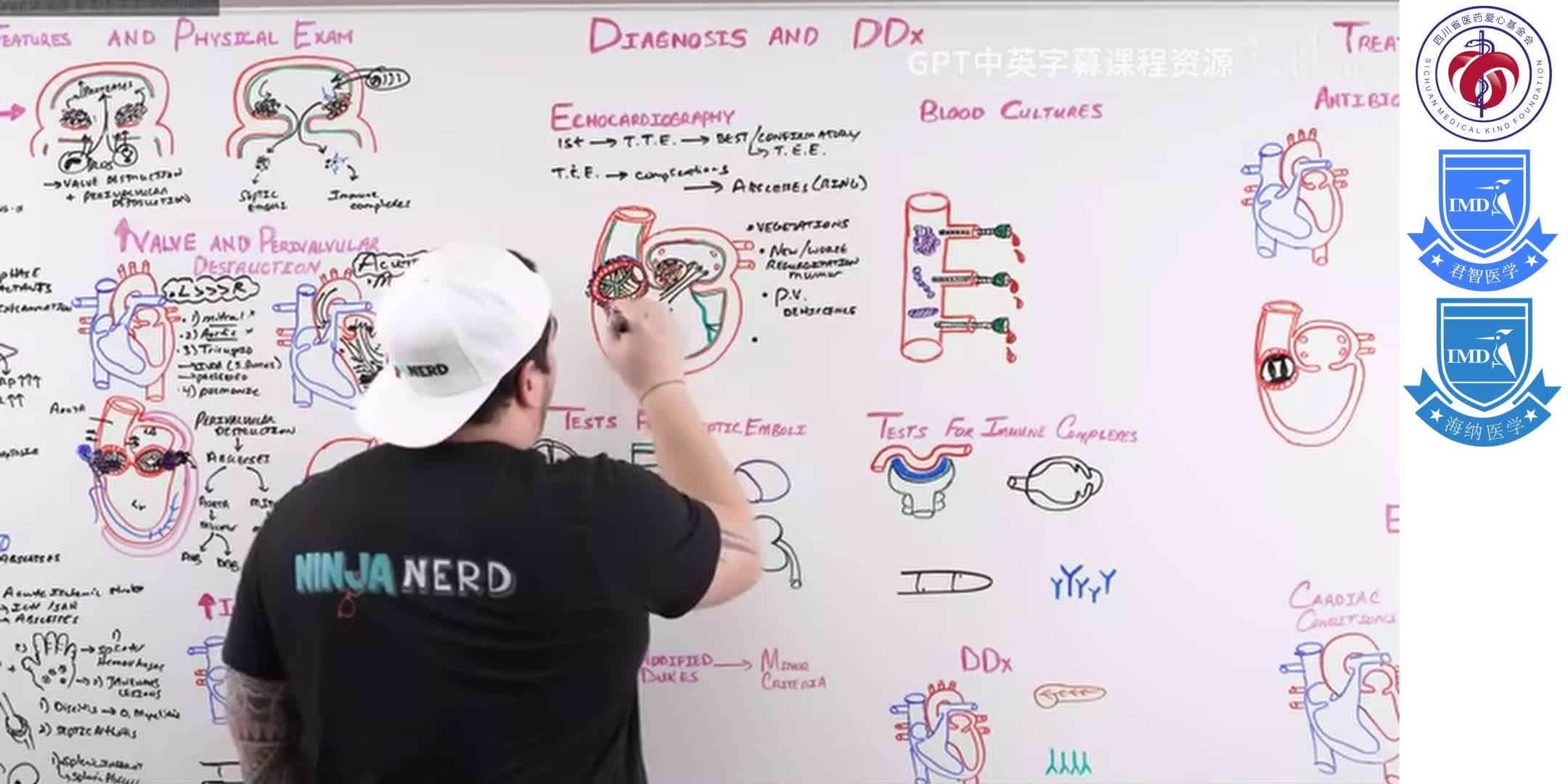 Infective Endocarditis 8