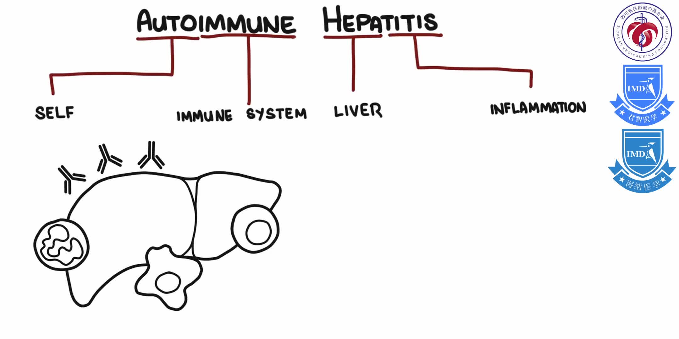 Autoimmune Hepatitis 1-1