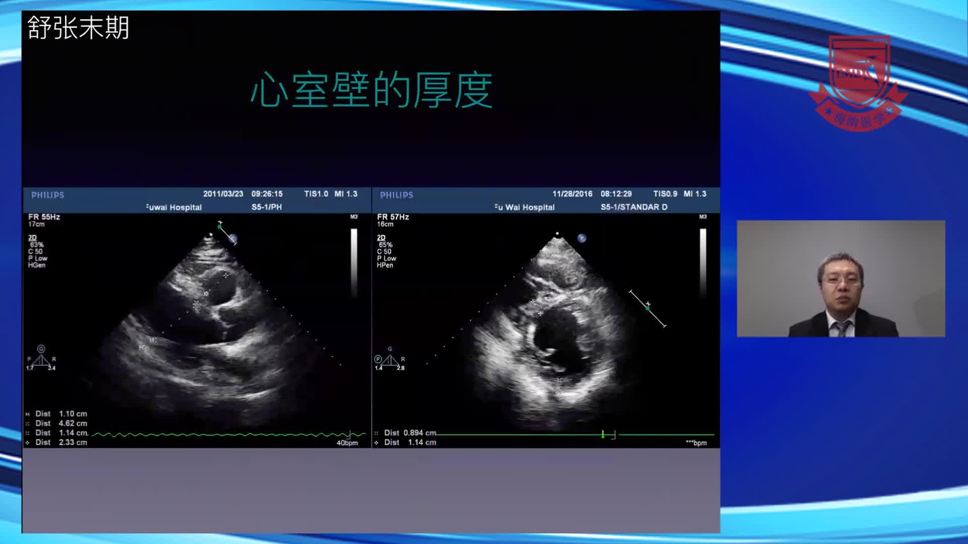 按部就班，我能行！--经胸超声心动图切面解读--段福建3