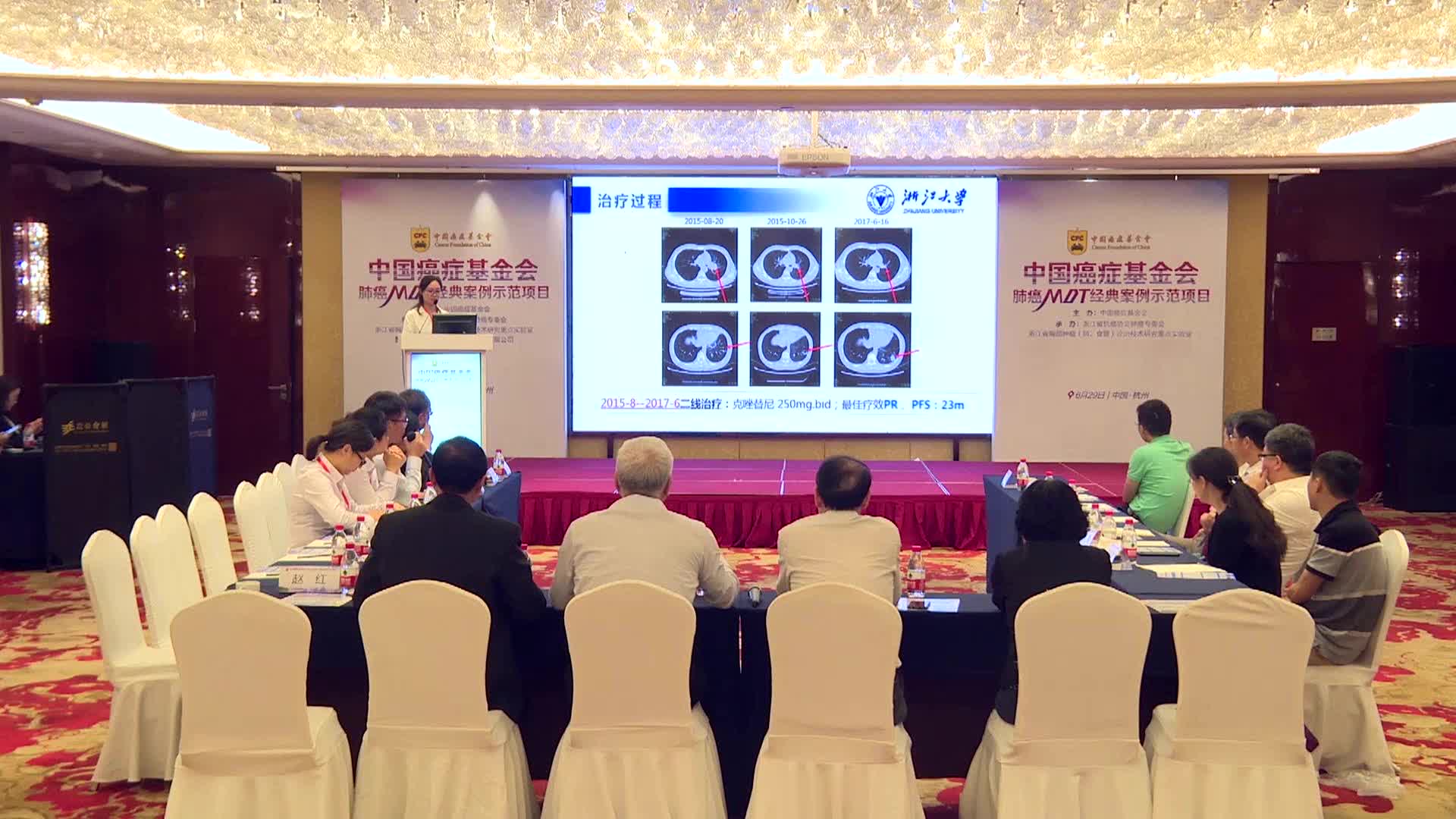 22..ALK阳性腺癌病人二线治疗效果及随访.