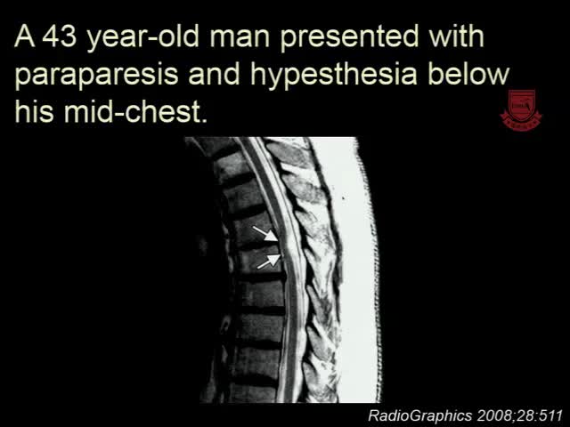 基于案例的神经影像学方法5