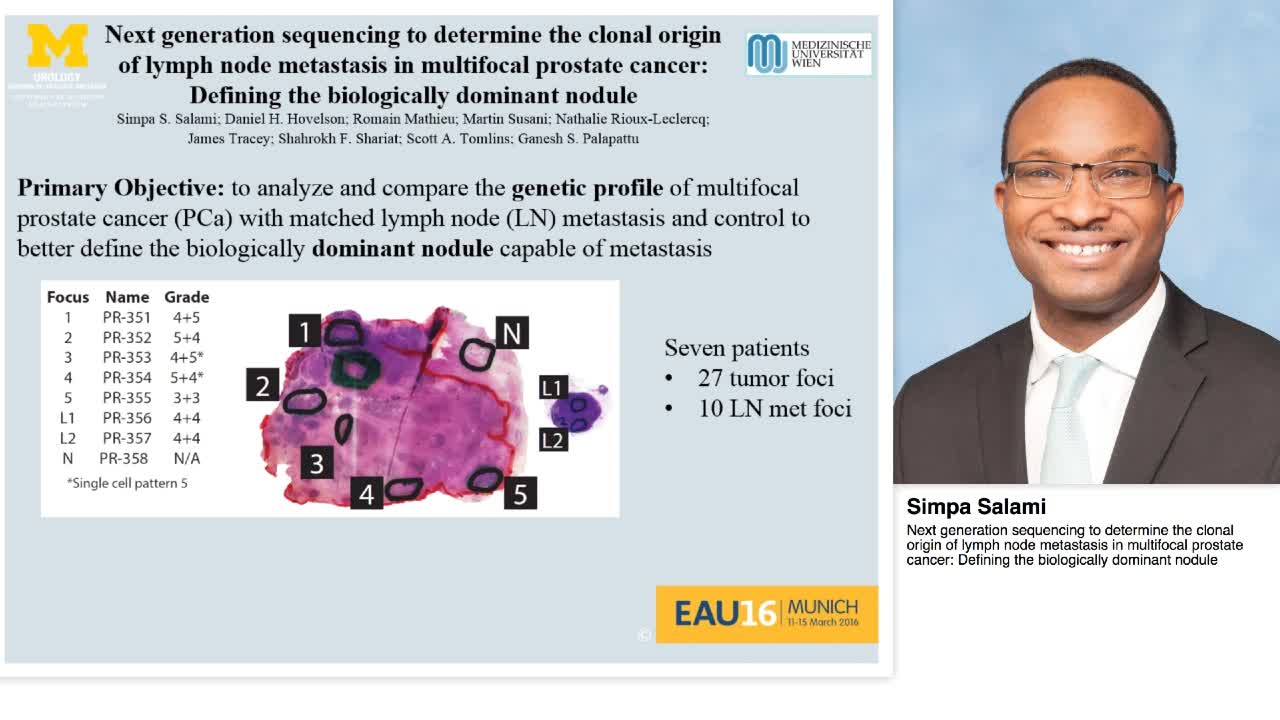Next generation sequencing to determine the clonal origin-