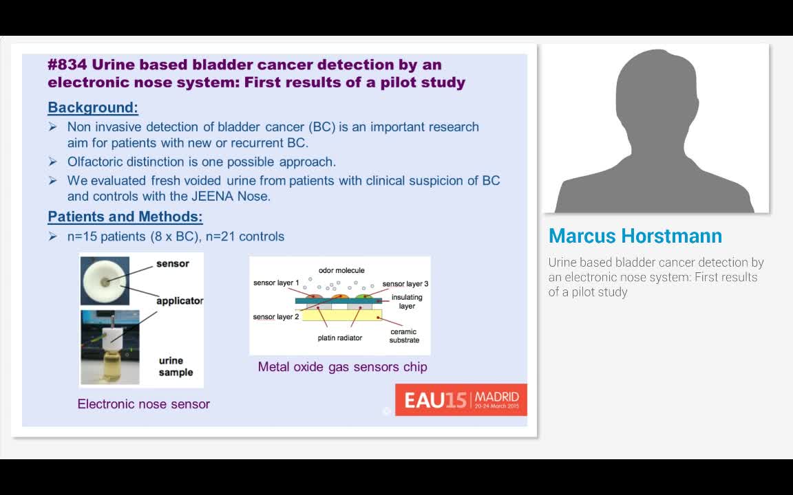Urine based bladder cancer detection by an electronic nos..-
