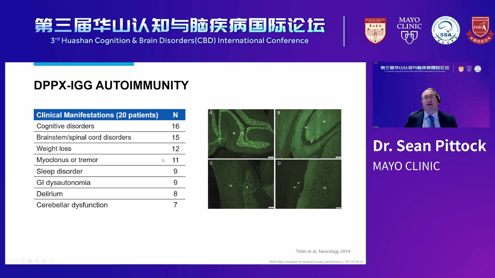 Autoimmune  Paraneoplastic Neurologic Disorders-Dr.Sean Pittock 4