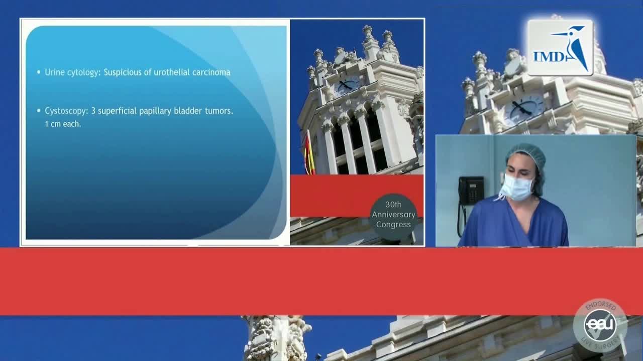 经尿道膀胱肿瘤切除手术（1）