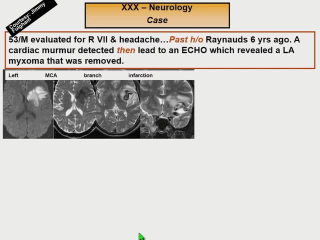 Neurologic Complications of Medical Disease An Overview