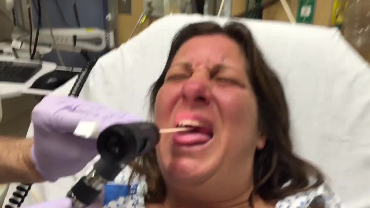 喉底疼痛的42岁女士