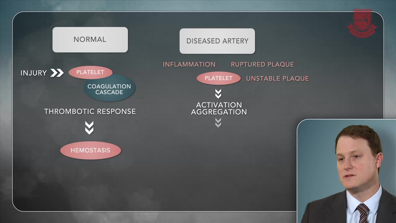 外周动脉疾病史患者血栓性心血管事件的二级预防药物1