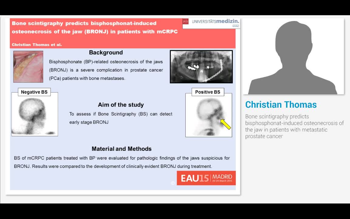 Bone scintigraphy predicts bisphosphonat-induced osteonec..-