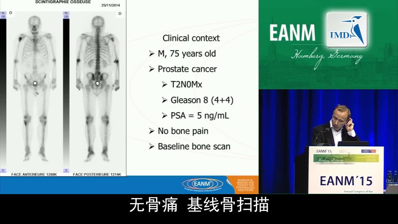软骨瘤等多模态影像挑战（3）