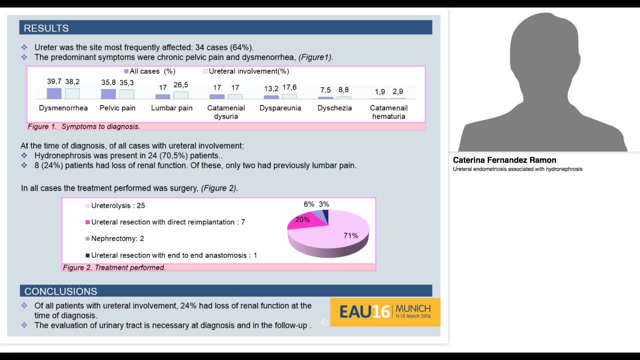 Ureteral endometriosis associated with hydronephrosis