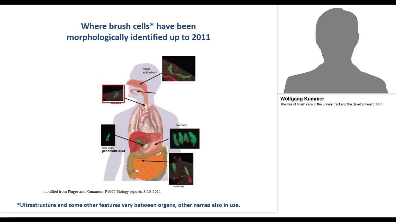 The role of brush cells in the urinary tract and the deve-