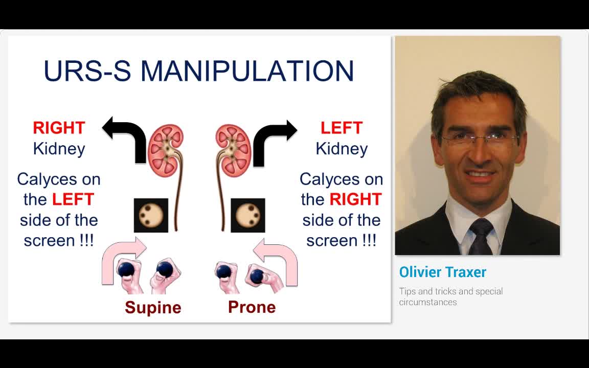 Tips and tricks and special circumstances