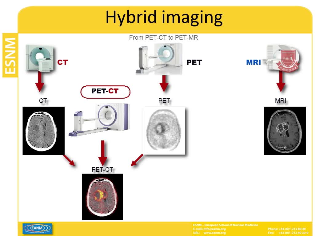 前列腺癌中的 PET MRI影像1