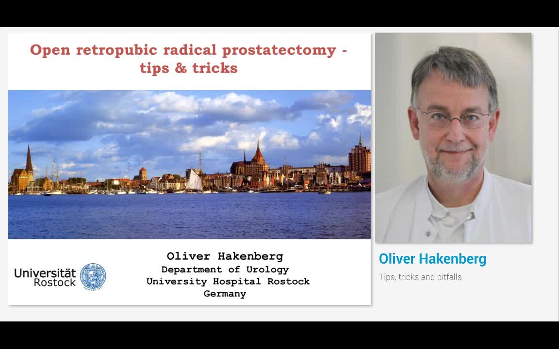 Tips, tricks and pitfalls