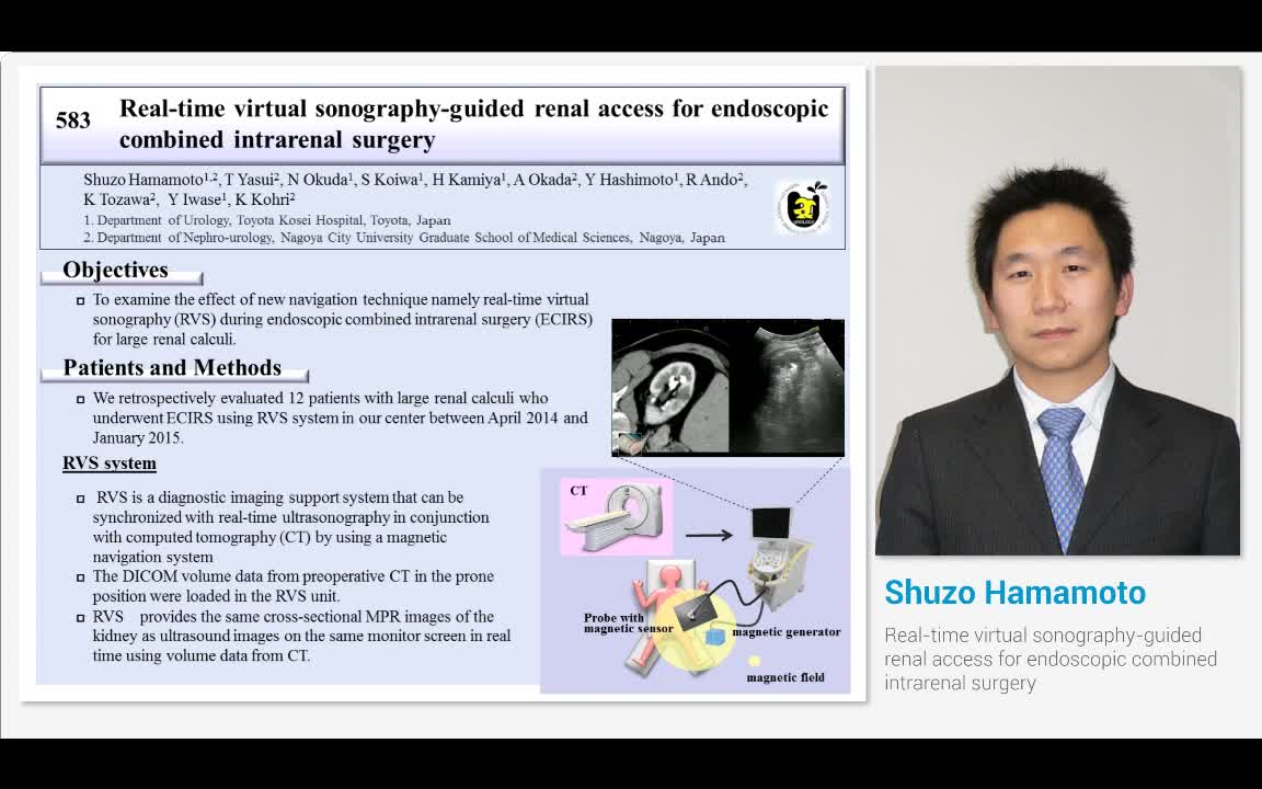 Real-time virtual sonography-guided renal access for endo..-