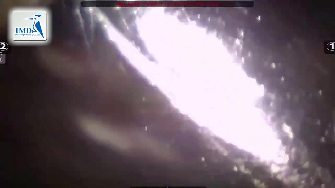 机器人辅助肺切除手术（1）