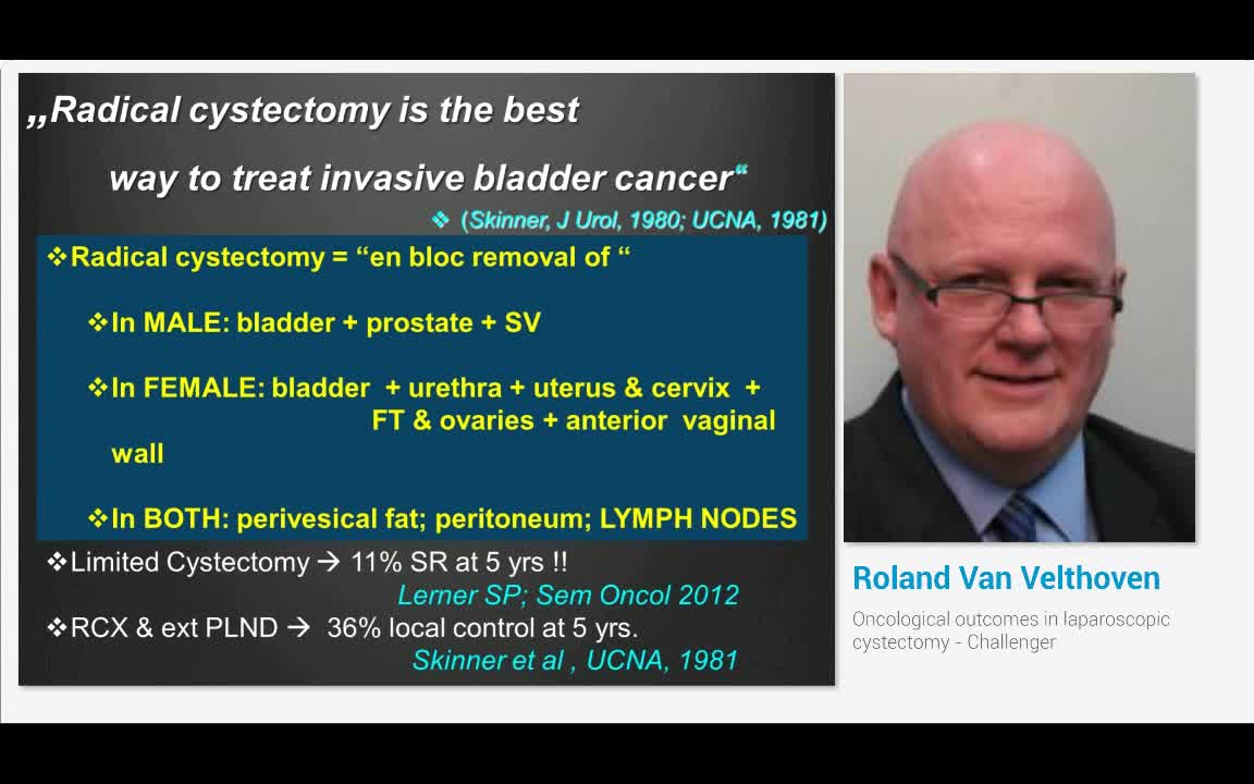 Oncological outcomes in laparoscopic cystectomy - Challenger
