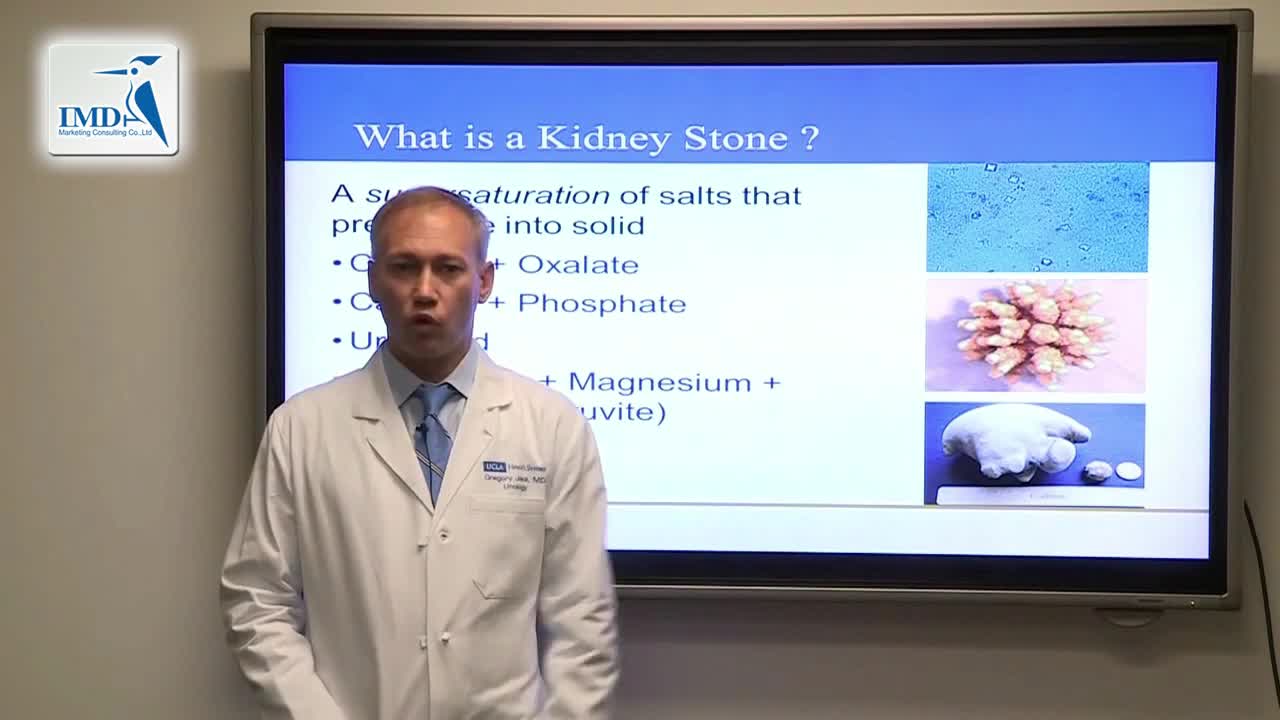 治疗肾结石的最新进步和发展（1）