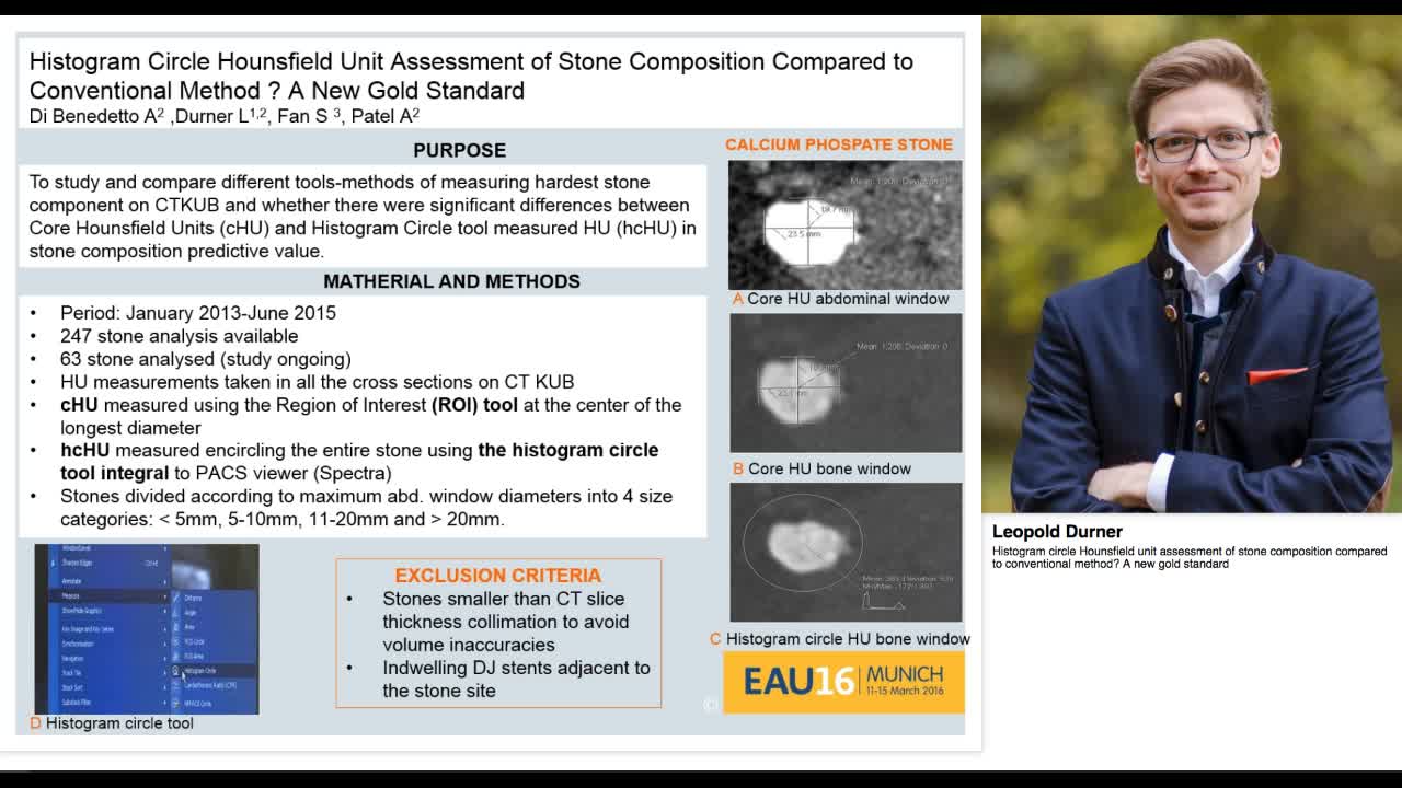 Histogram circle Hounsfield unit assessment of stone comp-