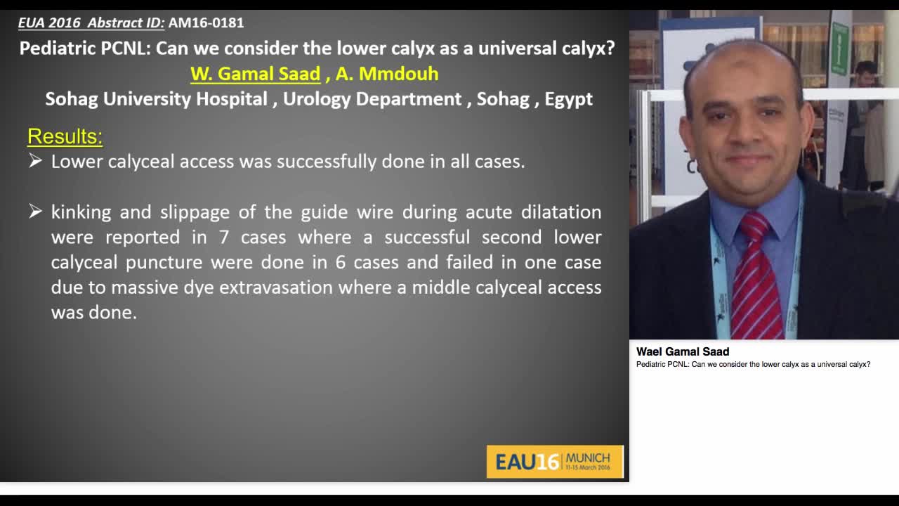 Pediatric PCNL, Can we consider the lower calyx as a univ-