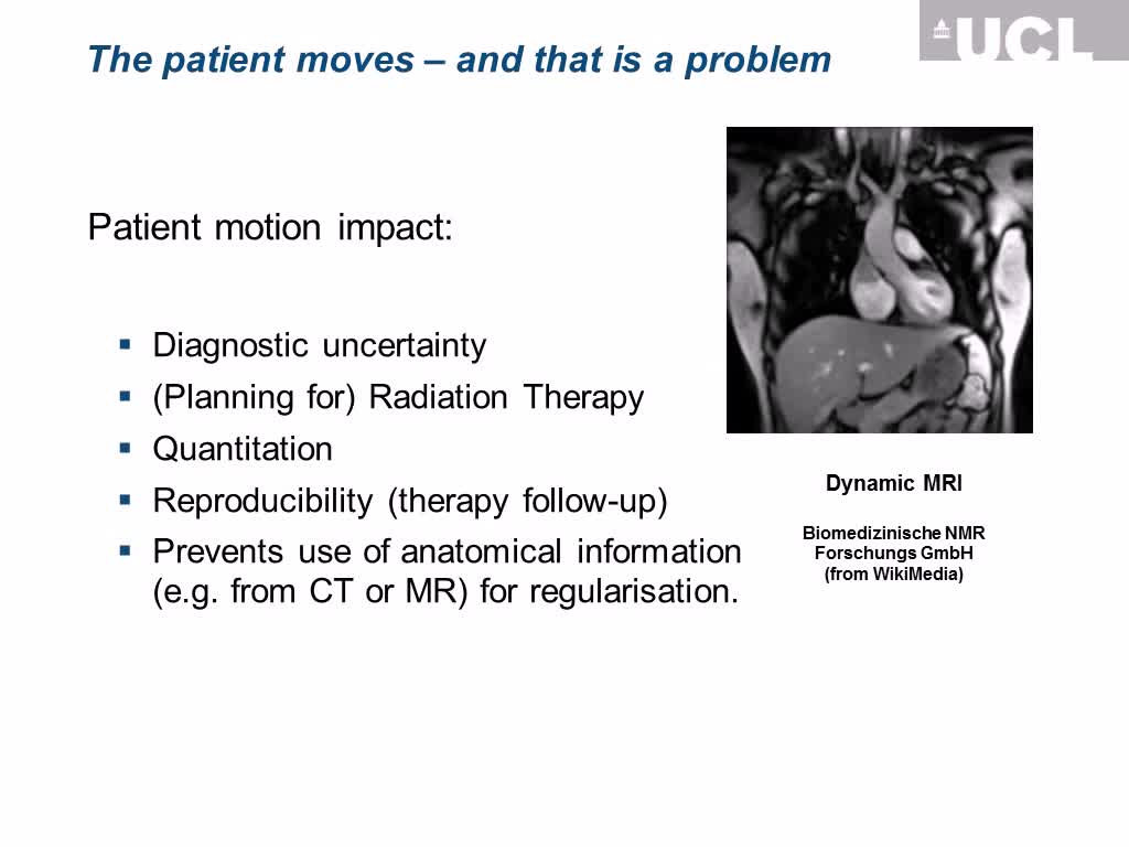 运动校正和选通原理