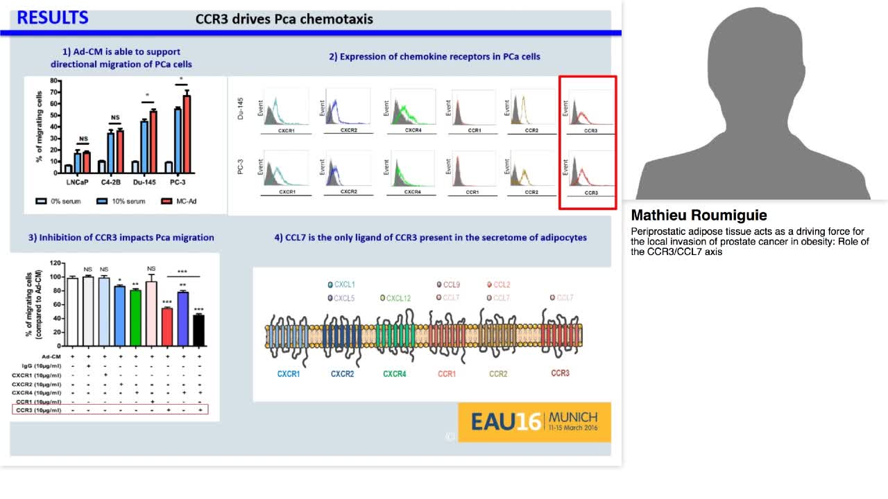 Periprostatic adipose tissue acts as a driving force for -