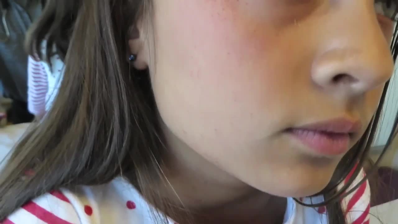 持续4天发烧、咳嗽和皮疹的7岁女孩