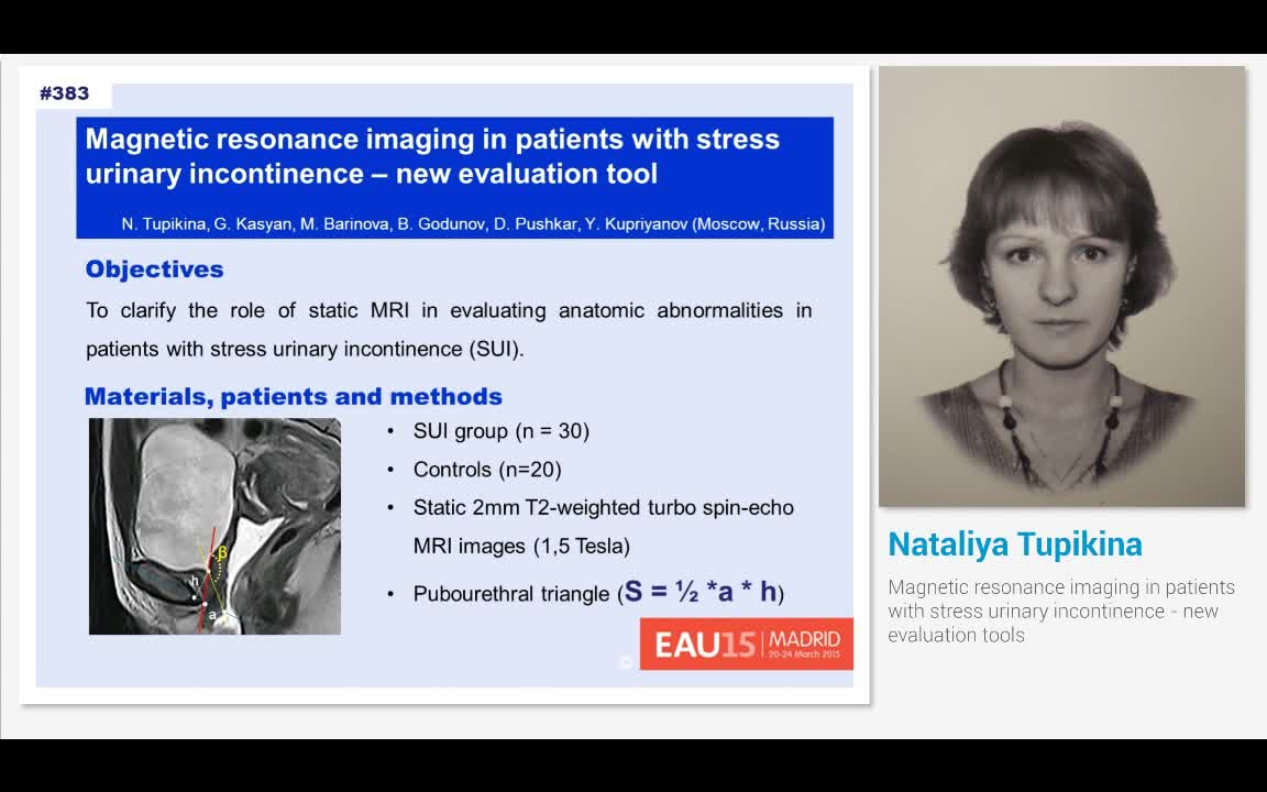 Magnetic resonance imaging in patients with stress urinar..-