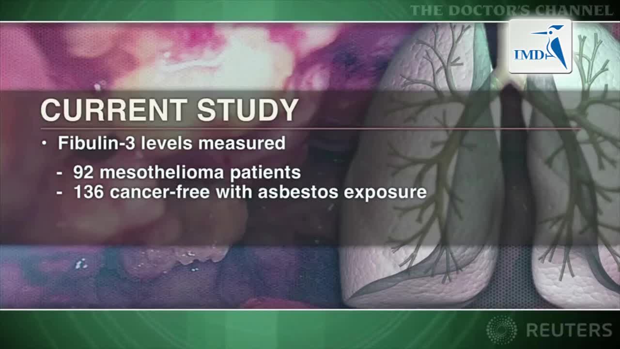 与大多数胸膜间皮瘤相关生物标记物